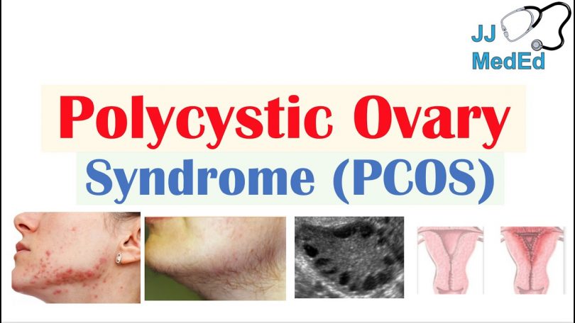 Top 8 reasons to adopt a low-carb diet for polycystic ovary syndrome